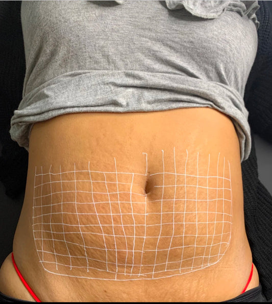 Fat Dissolve Training image 0